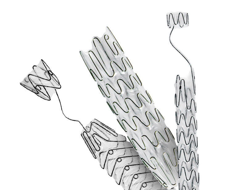 Стент мочеточниковый ALLIUM (URS). Мочеточниковый стент нового поколения